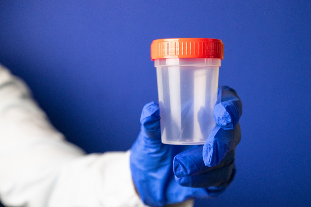 Person holding a drug testing cup